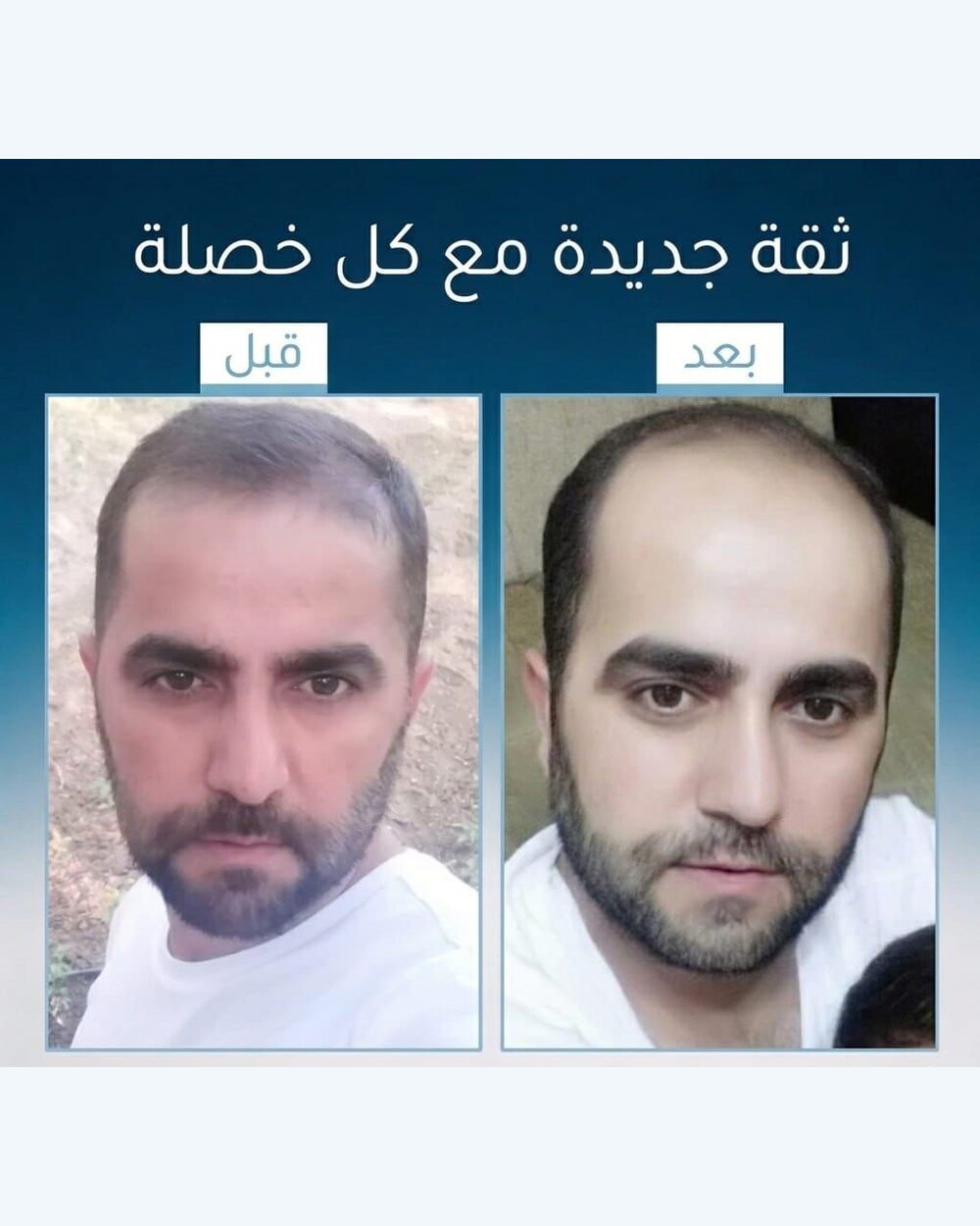 نتائج عميل FI BLUE 1
