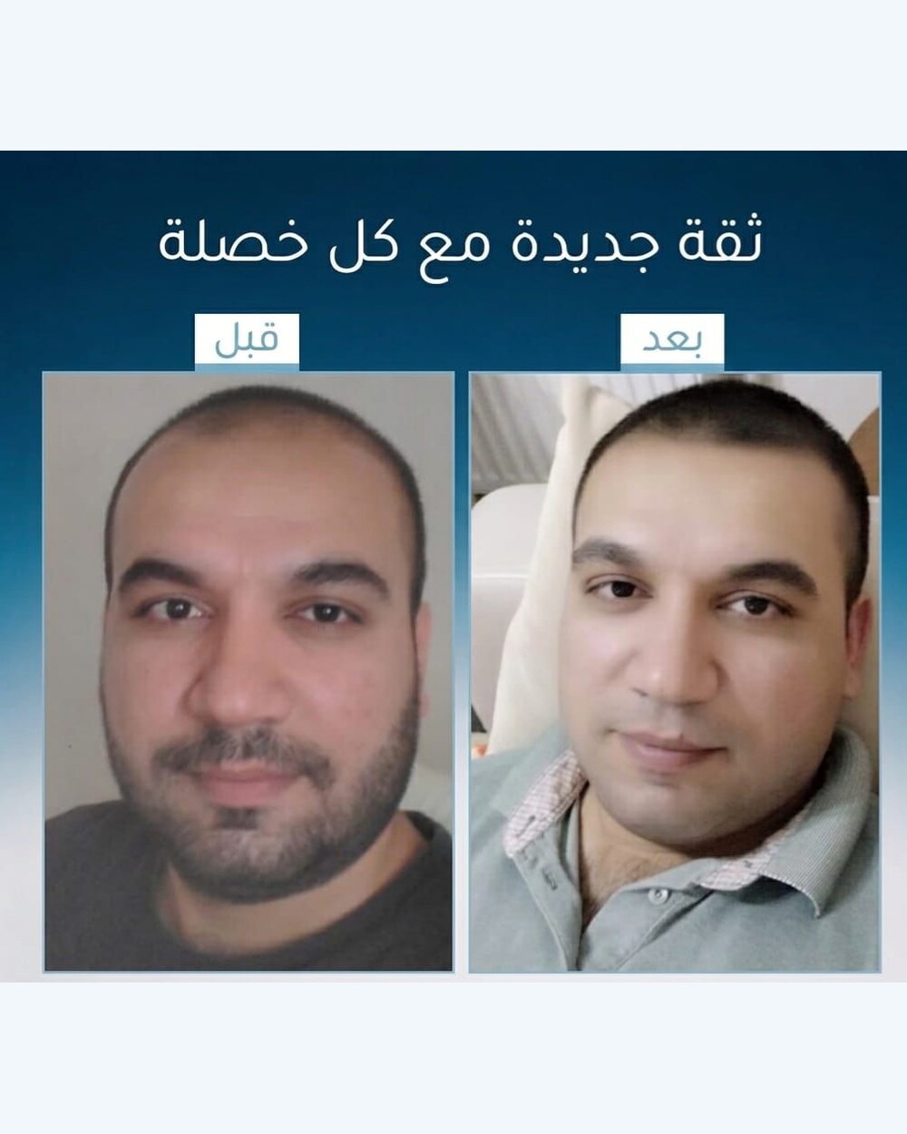 نتائج عميل FI BLUE 2