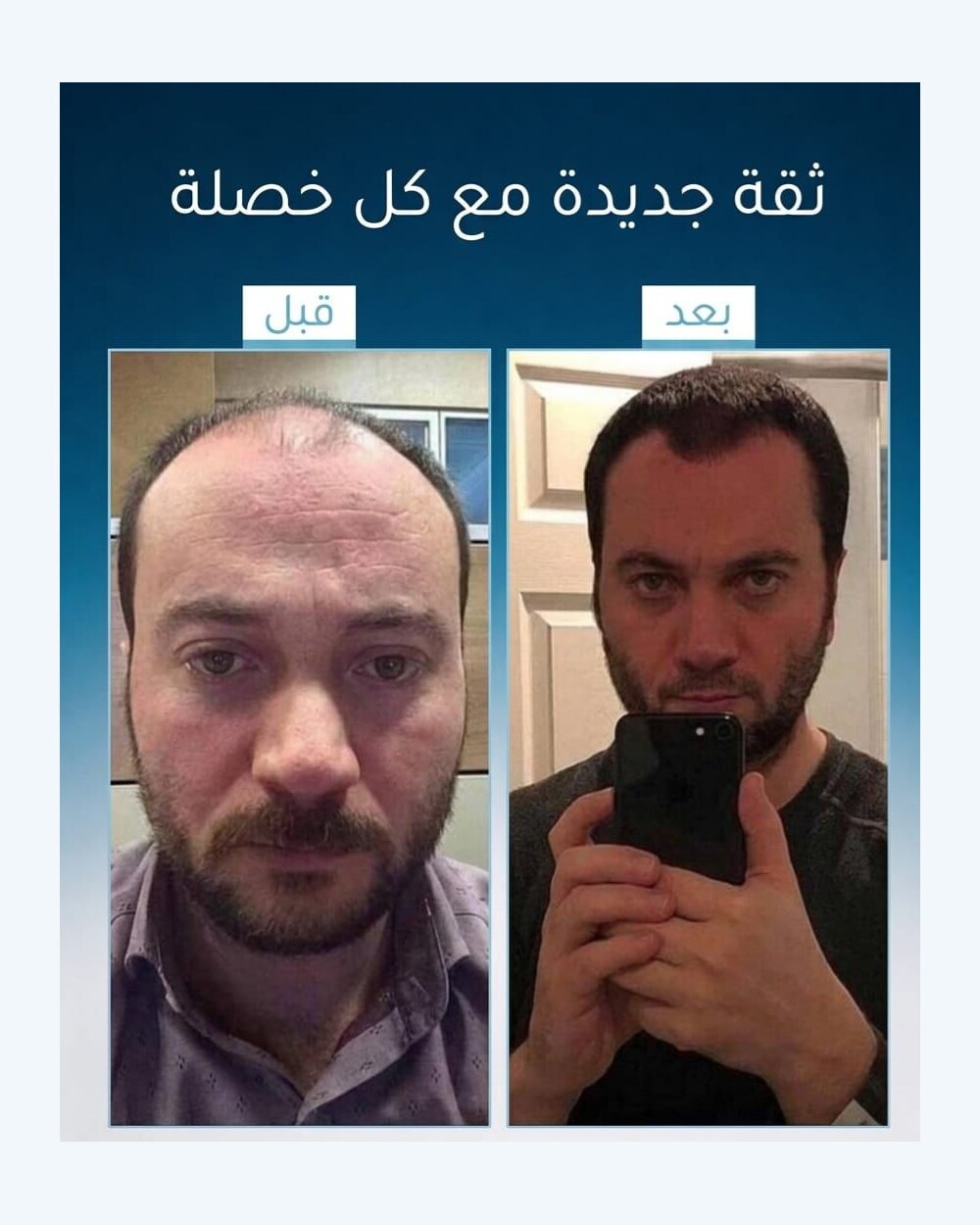 نتائج عميل FI BLUE 4