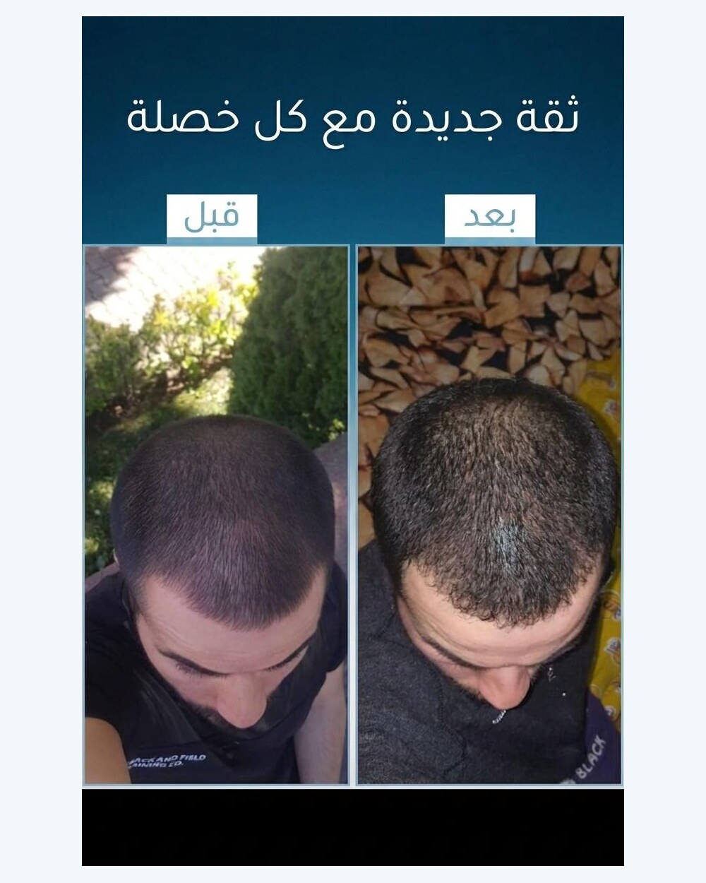 نتائج عميل FI BLUE 5