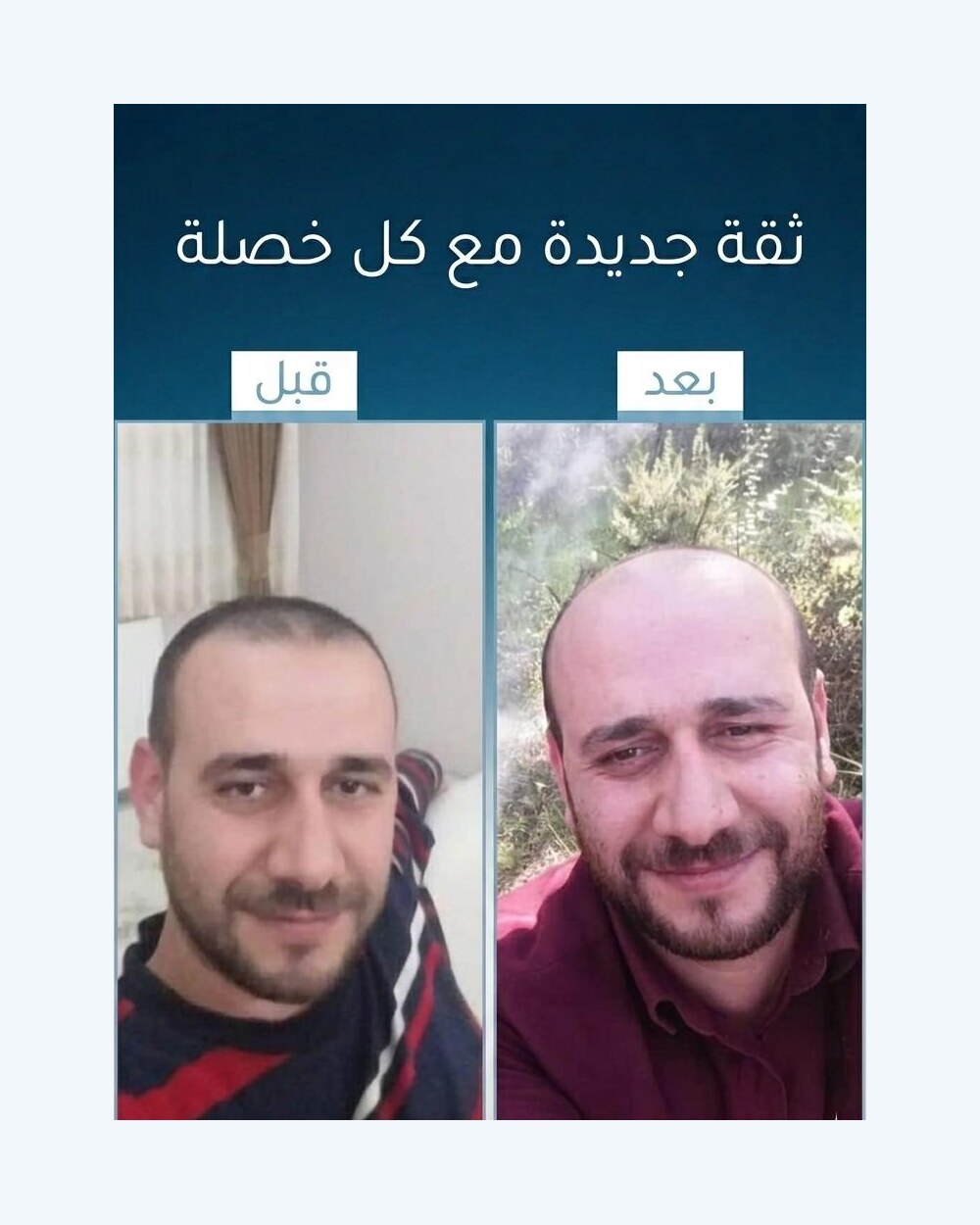 نتائج عميل FI BLUE 6
